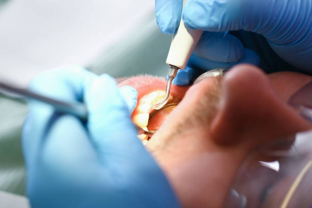 Best Orthodontic Emergency Dentist in Redfield, SD