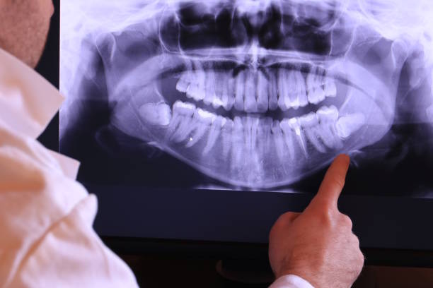 Best Broken or Cracked Tooth Emergency Dentist in Redfield, SD