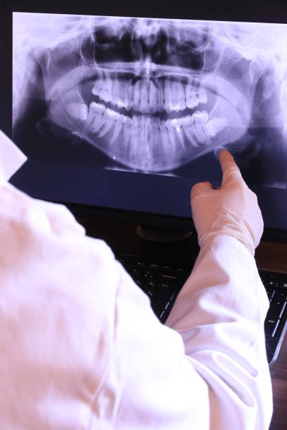 Best Emergency Dental Extractions in Redfield, SD